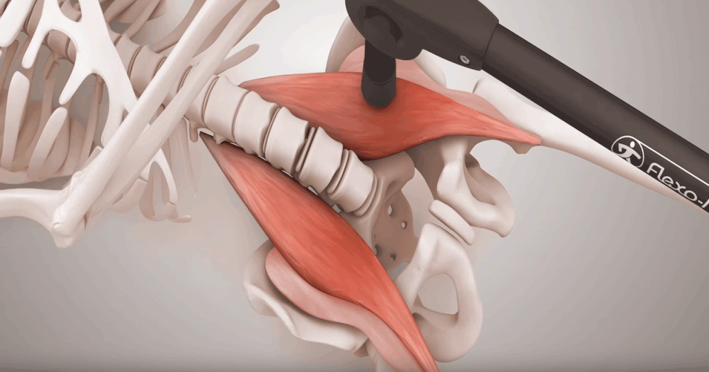 Psoas - Was ist die Psoas- Muskulatur - flexo-mag